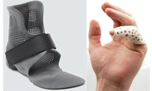 3D print medical healthcare dental orthopedics
